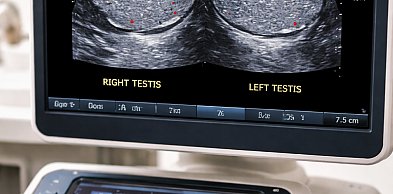 Usg 4d warszawa – nowoczesna diagnostyka prenatalna dla przyszłych rodziców